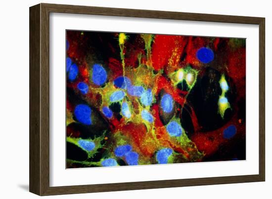 Immunofluorescent LM of HeLa Cells In Culture-Nancy Kedersha-Framed Photographic Print