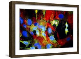 Immunofluorescent LM of HeLa Cells In Culture-Nancy Kedersha-Framed Photographic Print