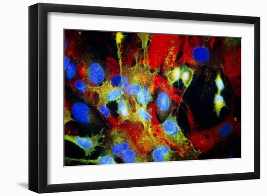 Immunofluorescent LM of HeLa Cells In Culture-Nancy Kedersha-Framed Photographic Print