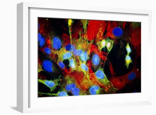 Immunofluorescent LM of HeLa Cells In Culture-Nancy Kedersha-Framed Photographic Print