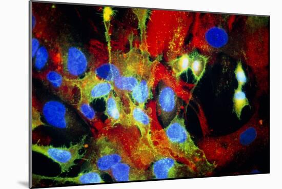 Immunofluorescent LM of HeLa Cells In Culture-Nancy Kedersha-Mounted Photographic Print