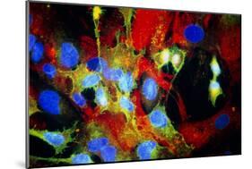 Immunofluorescent LM of HeLa Cells In Culture-Nancy Kedersha-Mounted Photographic Print