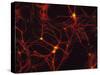 Immunofluorescent LM of Mammalian Brain Astrocytes-Nancy Kedersha-Stretched Canvas