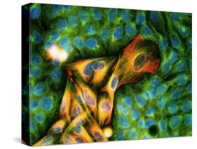 Immunofluorescent LM of Melanoma Cancer Cells-Nancy Kedersha-Stretched Canvas