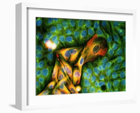 Immunofluorescent LM of Melanoma Cancer Cells-Nancy Kedersha-Framed Photographic Print