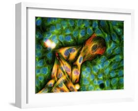 Immunofluorescent LM of Melanoma Cancer Cells-Nancy Kedersha-Framed Photographic Print