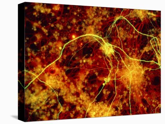 Immunofluorescent LM of Neuron Fibres & Astrocytes-Nancy Kedersha-Stretched Canvas