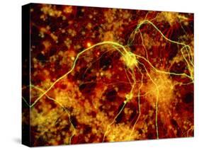 Immunofluorescent LM of Neuron Fibres & Astrocytes-Nancy Kedersha-Stretched Canvas