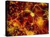 Immunofluorescent LM of Neuron Fibres & Astrocytes-Nancy Kedersha-Stretched Canvas
