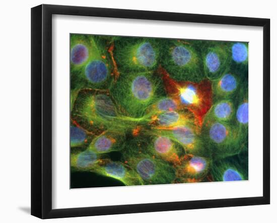 Immunofluorescent LM of Prostate Cancer Cells-Nancy Kedersha-Framed Photographic Print