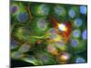 Immunofluorescent LM of Prostate Cancer Cells-Nancy Kedersha-Mounted Photographic Print