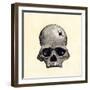 Inca Skull Showing Evidence of Prehistoric Trephining or Brain Surgery in Peru-null-Framed Giclee Print