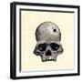 Inca Skull Showing Evidence of Prehistoric Trephining or Brain Surgery in Peru-null-Framed Giclee Print