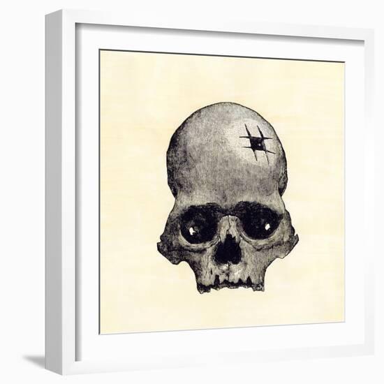 Inca Skull Showing Evidence of Prehistoric Trephining or Brain Surgery in Peru-null-Framed Giclee Print