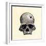 Inca Skull Showing Evidence of Prehistoric Trephining or Brain Surgery in Peru-null-Framed Giclee Print