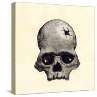 Inca Skull Showing Evidence of Prehistoric Trephining or Brain Surgery in Peru-null-Stretched Canvas