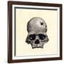 Inca Skull Showing Evidence of Prehistoric Trephining or Brain Surgery in Peru-null-Framed Giclee Print