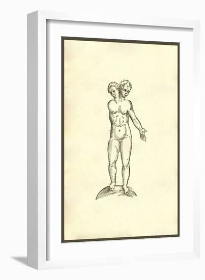 Infans Biceps Unico Brachio-Ulisse Aldrovandi-Framed Art Print