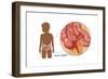 Inflamed Appendix-Monica Schroeder-Framed Art Print