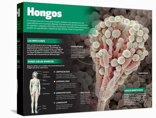 Infografía De Los Hongos, Seres Vivos Muy Simples Similares a Las Plantas-null-Stretched Canvas