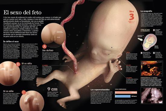 Poster, , large