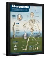 Infografía Del Esqueleto Humano, Detalle De Los Principales Huesos Y Diferencias Entre Sexos-null-Framed Poster