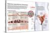 Infografía Del Sistema Reproductor Femenino Y Del Ciclo Menstrual-null-Stretched Canvas