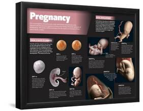 Infographic on Pregnancy-null-Framed Poster