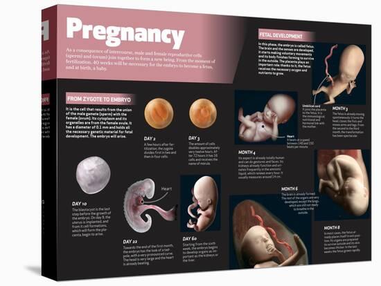 Infographic on Pregnancy-null-Stretched Canvas