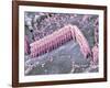 Inner Ear Hair Cells, SEM-Dr. David Furness-Framed Photographic Print