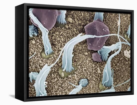 Inner Ear Sensory Cells, SEM-Steve Gschmeissner-Framed Stretched Canvas