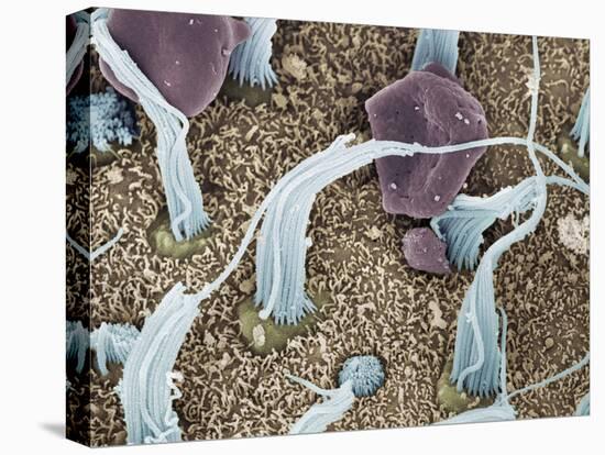 Inner Ear Sensory Cells, SEM-Steve Gschmeissner-Stretched Canvas