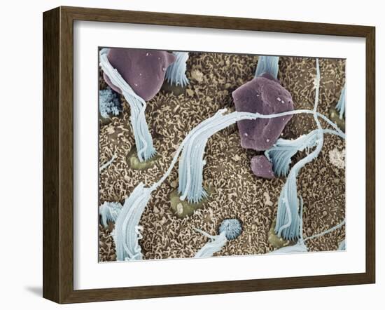 Inner Ear Sensory Cells, SEM-Steve Gschmeissner-Framed Photographic Print