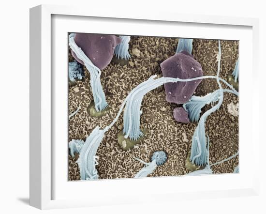 Inner Ear Sensory Cells, SEM-Steve Gschmeissner-Framed Photographic Print