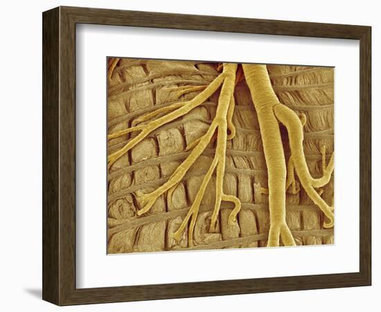 Interior of moth larva-Micro Discovery-Framed Photographic Print