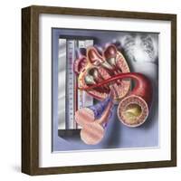 Interior View of Heart with Detail of Muscle Cells and Atherosclerotic Artery-null-Framed Art Print