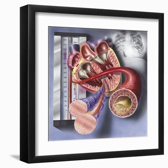 Interior View of Heart with Detail of Muscle Cells and Atherosclerotic Artery-null-Framed Art Print