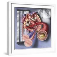 Interior View of Heart with Detail of Muscle Cells and Atherosclerotic Artery-null-Framed Art Print