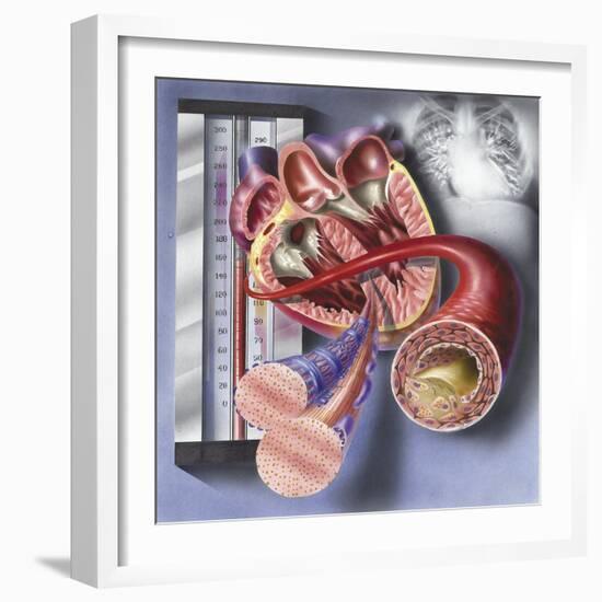 Interior View of Heart with Detail of Muscle Cells and Atherosclerotic Artery-null-Framed Art Print