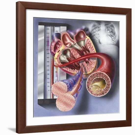 Interior View of Heart with Detail of Muscle Cells and Atherosclerotic Artery-null-Framed Art Print