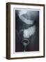 Intestine Barium-null-Framed Art Print