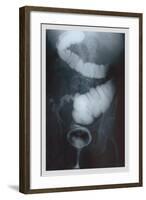 Intestine Barium-null-Framed Art Print