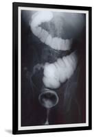 Intestine Barium-null-Framed Art Print