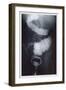 Intestine Barium-null-Framed Art Print