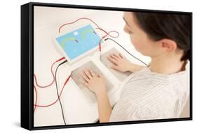 Iontophoresis for Excess Sweating-Science Photo Library-Framed Stretched Canvas