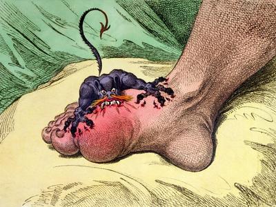 The Gout, Published by Hannah Humphrey in 1799