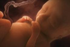 Human Foetus In the Womb, Artwork-Jellyfish Pictures-Laminated Premium Photographic Print