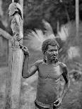 Malformation of the Ears, Solomon Islands, 1920-JW Beattie-Giclee Print