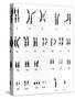 Karyotype of Chromosomes In Down's Syndrome-L. Willatt-Stretched Canvas