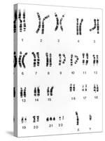 Karyotype of Chromosomes In Down's Syndrome-L. Willatt-Stretched Canvas